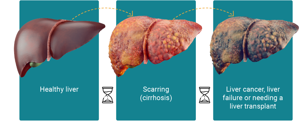 Infographic_Liver_Health_v2